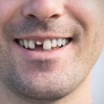 Japanese Scientists Begin Human Trials of TRG-035 to Regrow Real Teeth by 2030