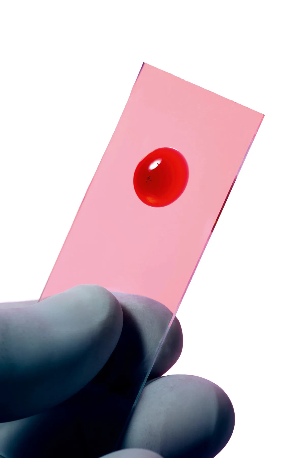 17-worst-ideas-21st-century-fingerblood-cancer Blood sample on microscope slide.